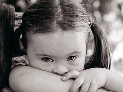 Παγκόσμια Ημέρα Συνδρόμου Down