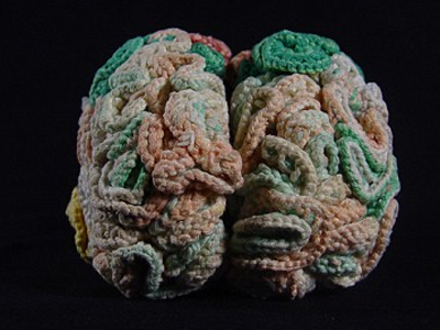 Έπλεξε έναν… εγκέφαλο