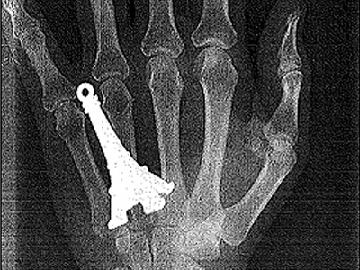 Ένα… «αναμνηστικό» ατύχημα