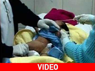 Γεννήθηκε μωρό με τρίτο πόδι