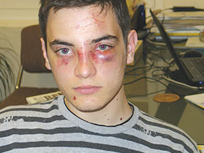 Φοιτητής ξυλοκοπήθηκε στην Κρήτη