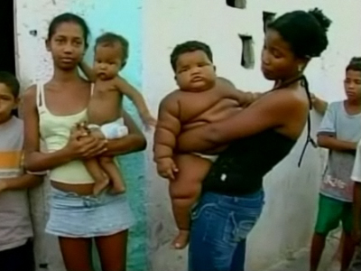 Μωρό – γίγαντας στην Κολομβία