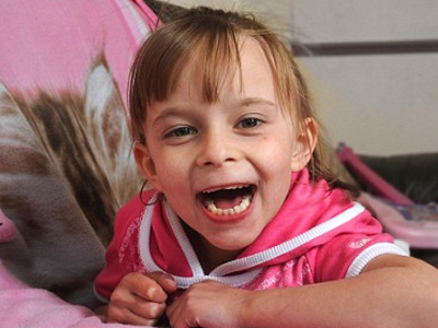 Ζει με πέντε σπλήνες, ανάποδο συκώτι και τρύπα στην καρδιά