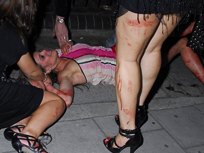 Από θαύμα γλίτωσε τον ακρωτηριασμό η Danielle Lloyd