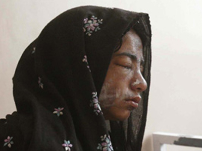 Τις τύφλωσαν με οξύ γιατί πήγαιναν σχολείο