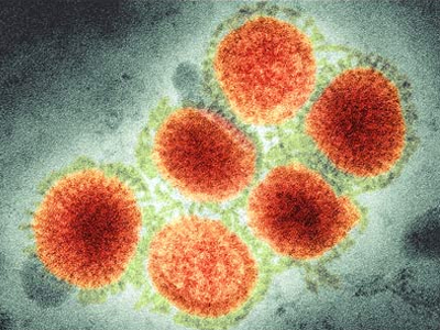 Η Γαλλία μένει εκτός… πανδημίας