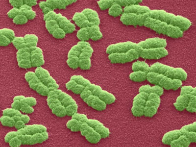 Βρέθηκαν γονίδια που προκαλούν καρκίνο των όρχεων