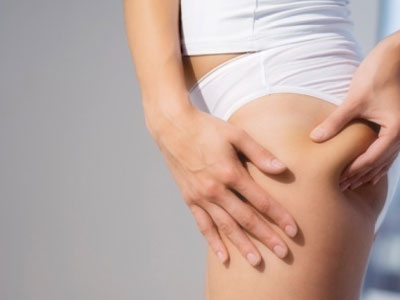 Κυτταρίτιδα; Μία ανώδυνη, αλλά άκρως ενοχλητική ασθένεια!  Μέθοδοι θεραπείας.