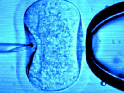 Νέες εξελίξεις στην εξωσωματική γονιμοποίηση