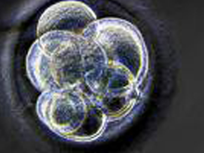 Πειραματική θεραπεία με βλαστοκύτταρα για το εγκεφαλικό