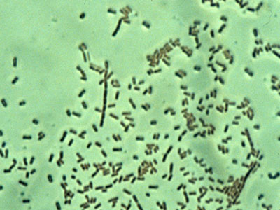 Νέα θεραπεία καταστρέφει καρκινικά κύτταρα