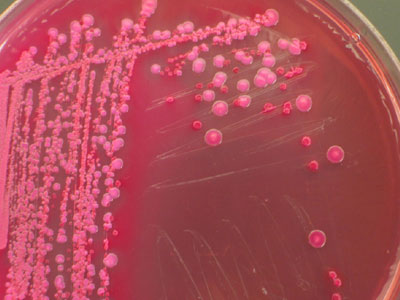 Συναγερμός για επικίνδυνο βακτηρίδιο σε νοσοκομείο