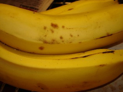 Οι μελανιές μου και… εγώ!