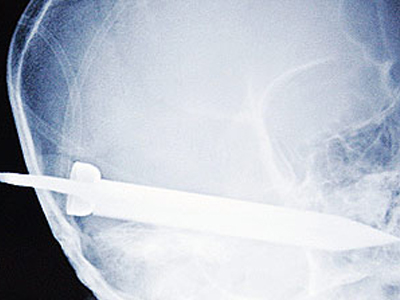 Τον μαχαίρωσε ο πατέρας του στο κεφάλι