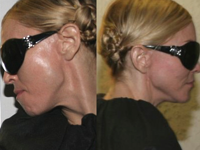 Οι ”θυσίες” της Μαντόνα λίγο πριν τα Όσκαρ