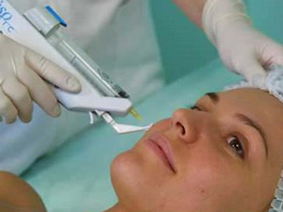 Προσοχή στις θεραπείες με λέιζερ