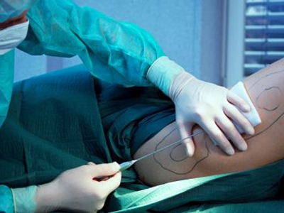 Χρησιμοποίησε ανθρώπινο λίπος … για βενζίνη