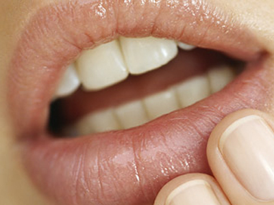 Πώς να «κρύψετε» τον επιχείλιο έρπητα