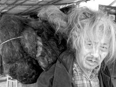 Ακούρευτος επί 60 χρόνια για χάρη… των ασθενών του