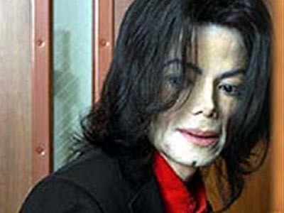 Γεμάτο σημάδια από ενέσεις το σώμα του Michael Jackson