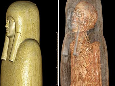 Ακτινογραφία μούμιας … 3.000 ετών!