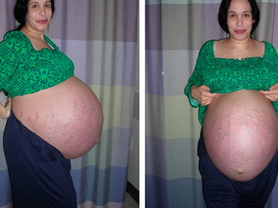 Φόβοι ότι η μητέρα οκτάδυμων κακοποιεί τα παιδιά της