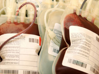 Κρούσμα Aids σε 70χρονη από μετάγγιση αίματος