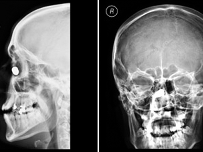 Τον έσωσε… η μύτη του