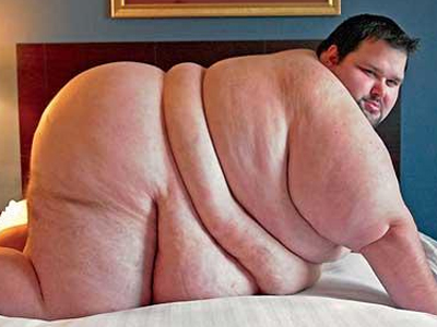 Παχύσαρκος φωτογραφίζεται γυμνός για ημερολόγιο