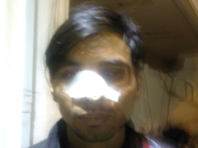 Θύματα του ξενοφοβισμού