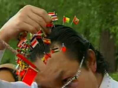 205 βελόνες στο κεφάλι του