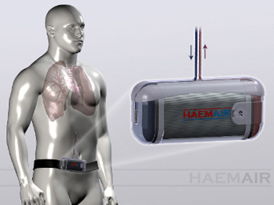 Επιστήμονες κατασκεύασαν φορητό πνεύμονα