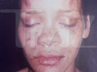 Η φωτογραφία της Ριάνα μετά τον ξυλοδαρμό από το φίλο της