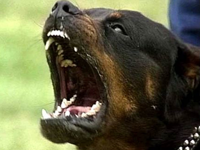 Επίθεση Ροτβάιλερ σε 4χρονη