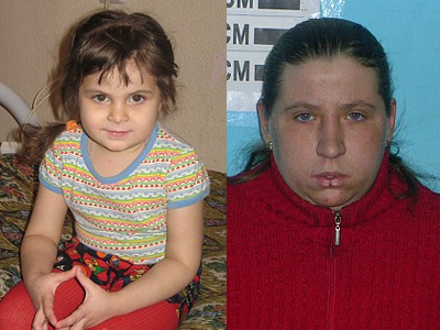 Σκυλιά μεγάλωσαν κοριτσάκι