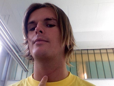 «Μαγνήτης» για τις γυναίκες οι ουλές στο ανδρικό πρόσωπο