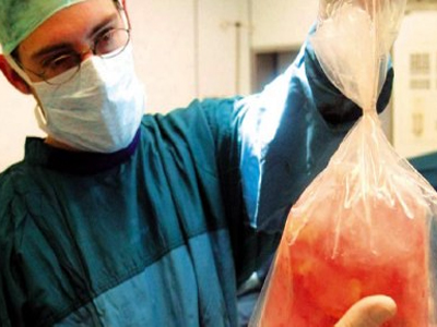 ”Κύκλωμα” παράνομων μεταμοσχεύσεων στο Κόσσοβο