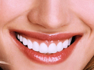 Τα «trends» της αισθητικής οδοντιατρικής