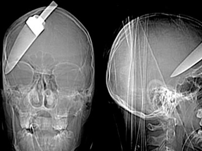 Κι όμως επέζησε!