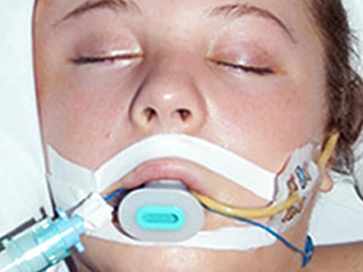 Χτύπησαν 15χρονη με το αυτοκίνητο και την εγκατέλειψαν