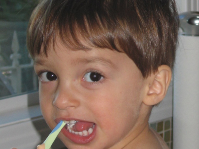 Νέα ανακάλυψη για την προστασία των παιδικών δοντιών