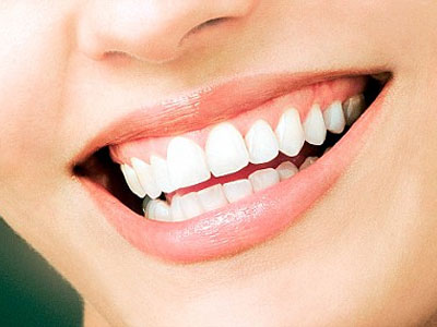 Venners πορσελάνης