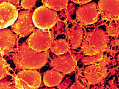 Μεσεγχυματικά βλαστικά κύτταρα από πλακουντιακές πηγές – Πλεονεκτήματα για την Αναγεννητική Ιατρική