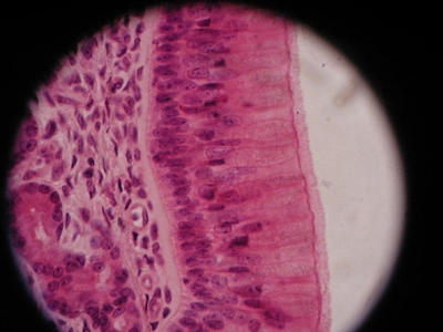 Αισθητικές επεμβάσεις με βλαστοκύτταρα