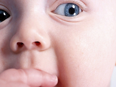 Τα μεγαλόσωμα βρέφη διατρέχουν περισσότερους κινδύνους εμφάνισης όγκων