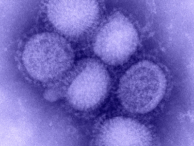 Πέμπτο κρούσμα της νέας γρίπης στην Ελλάδα