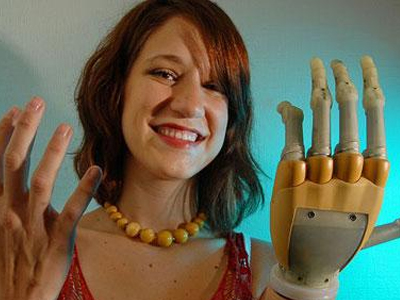 Το βιονικό χέρι, από τις μεγαλύτερες εφευρέσεις