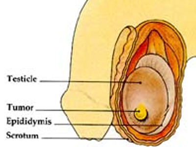 SEXUALITY: Ζήτημα μερικής συστροφής