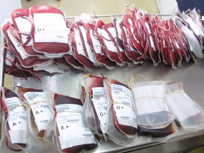 Αντιδραστήρες για τον έλεγχο του αίματος