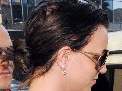 Χάνει τα μαλλιά της;